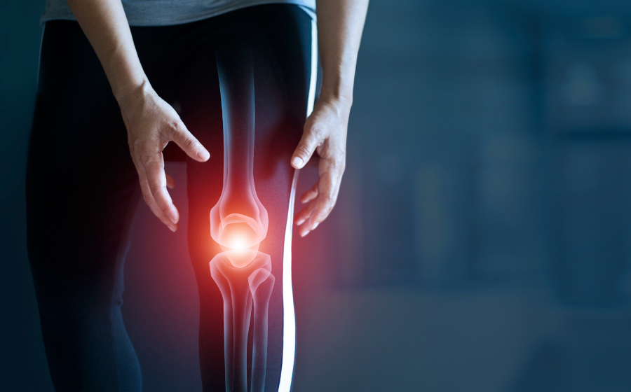Osteoartrose